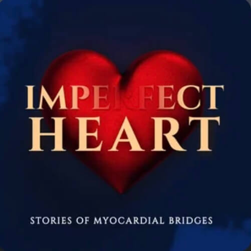Imperfect Heart Jeff Holden